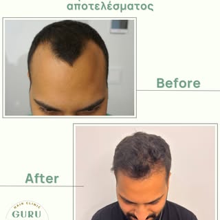 Για περισσότερες πληροφορίες ή εξατομικευμένη αξιολόγηση, επικοινώνησε μαζί μας.
📍 Ηρώων Πολυτεχνεί