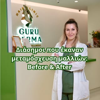 Πολλοί διάσημοι έχουν επιλέξει τη μεταμόσχευση μαλλιών και τα αποτελέσματα μιλούν από μόνα τους!
 
Σ