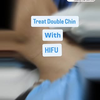 “Get a snatched jawline without surgery 😍✨
Chin HIFU treatment helps in double chin reduction, skin
