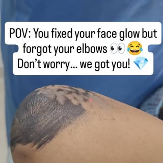 Your face is glowing… but what about your elbows? 👀

Don’t let dark, rough elbows ruin your glow ✨
