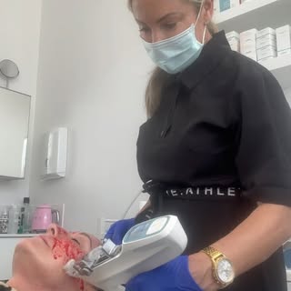 Our ultimate skin boosting treatment “Vital injector 2”. This amazing machine delivers product into 