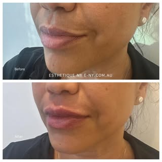 Pop in for a complimentary consultation.  From. Crystal hydrabrasion, glass facial …many more servic