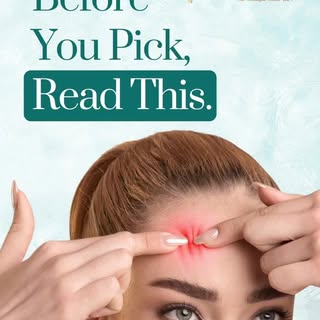 That one moment in front of the mirror… when you decide to pick a pimple — it feels small, harmless,