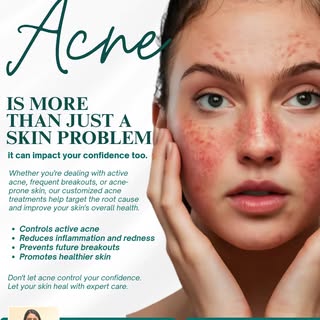 ✨ Acne is not just about your skin — it can affect how you feel too. ✨

Breakouts, redness, and acne