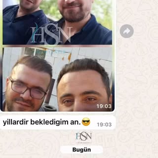 Değişimin böylesi dedirten işlem sonucu ve memnuniyeti 👏🏻
Sizlerde bu değişimden ihtiyacım var diy