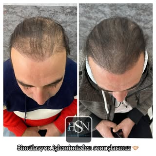 Simülasyon işlemlerimiz son hız devam ediyor 👉🏻👈🏻