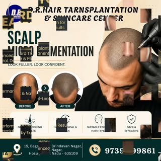 ✨ Scalp Micropigmentation (SMP) – Get the Look of a Fuller, Natural Hairline! ✨

Looking for a non-s