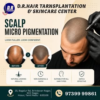 ✨ Scalp Micropigmentation (SMP) ✨
Look Fuller. Look Confident.

Restore the appearance of a fuller h