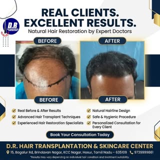 ✨ முடி உதிர்வால் கவலைப்படுகிறீர்களா? ✨

💇‍♂️ இயற்கையான முடி வளர்ச்சி • இயற்கையான தோற்றம் • நிரந்தர 