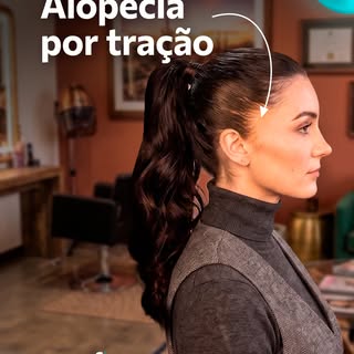 Quem prende o cabelo todos os dias em rabos de cavalo, coques ou tranças muito apertadas pode estar 