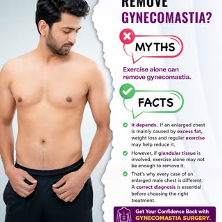 💪 Will Exercise Remove Gynecomastia? Let’s Separate Myth from Fact!

Exercise can help reduce exces