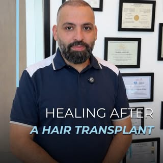 Hair transplant recovery is a gradual process, and every stage of healing matters. Following the rec