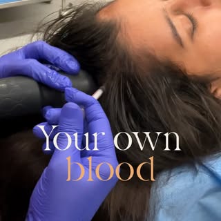 Your own blood. Growing your hair back. 🩸
GFC — Growth Factor Concentrate — is the next generation 