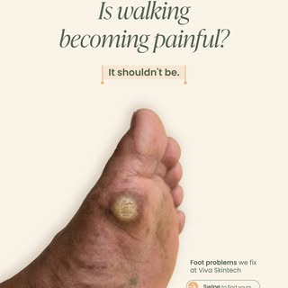 Is walking becoming painful? It shouldn't be. 👣

Corns. Ingrown toenails. Plantar warts. Cracked he
