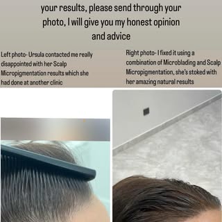 BE CAREFUL!!! Trust me, you would rather pay a little extra doing Scalp Micropigmentation at the rig