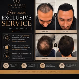 EXCLUSIVE NEW OFFER!!!
Who’s ready for some new content. 
At HairLoss establishment, We come to you