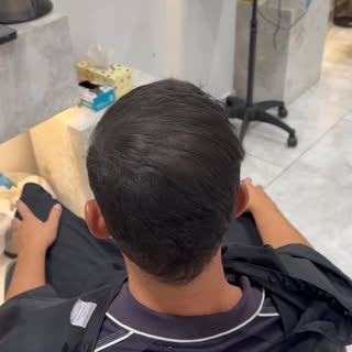 Before & After Scalp Micropigmentation 
Price ranges from $1000-$3500.
Located in Sydney. Dm for boo