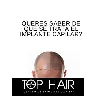 😷 Implante capilar técnica FUE
.
📲 Envianos tu consulta por DM o al wapp 1156189999
.
☑️ Solucione