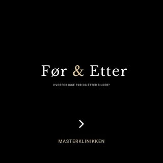 Hvorfor har vi ikke før og etter bilder, på sosiale medier og hjemmeside?📱
.
.
.
.
#fyp #hårtranspl