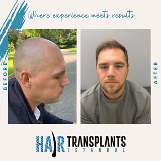 Natural transformation through precision and care. Real results, real confidence.
Thinking about a h