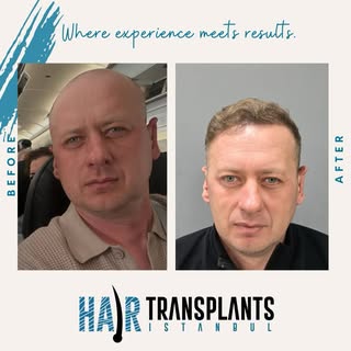 7 months in, and he’s already looking amazing. 
We love seeing your journey come to life.
If you’re 