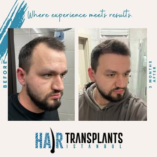 3 month update. Early growth is coming in, and we’re excited for what’s ahead. The best results are 