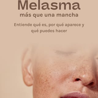 El melasma es mucho más que una mancha. 

Es una condición crónica influenciada por el sol, las horm