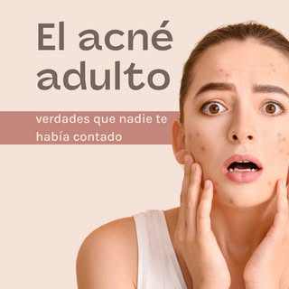 El acné no siempre se queda en la adolescencia. 

Hormonas, estrés, genética o incluso tu rutina de 