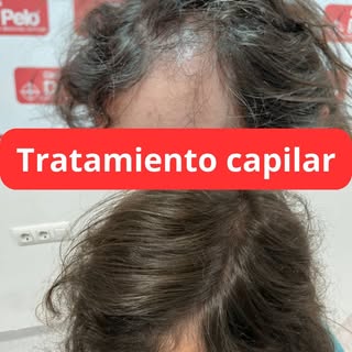 40 días pueden marcar la diferencia.

El cambio que estás a punto de ver no es casualidad. 

Este re