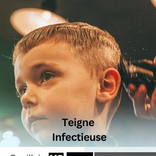 La teigne est une infection fongique du cuir chevelu, fréquente chez les enfants. Elle entraîne une 
