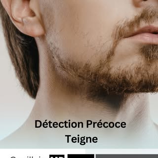 Des démangeaisons, croûtes ou zones sans cheveux ? Consultez rapidement pour éviter la propagation d