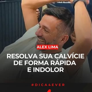 Se você conhece algum calvo que deseja mudar o visual, compartilhe esse vídeo pra ele.

O Dr. Hollyw