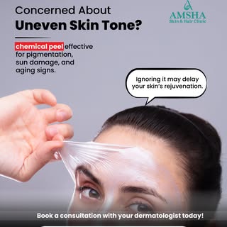 Chemical peels help treat uneven skin tone, sun damage, acne scars, and early signs of aging, reveal