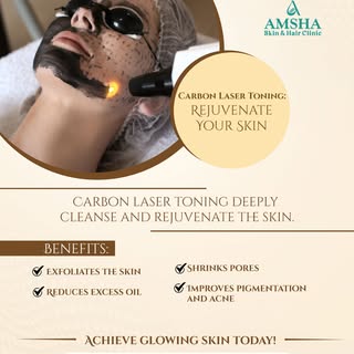 Deep cleansing laser treatment reduces oil, pigmentation, and uneven skin tone. Carbon peel laser im
