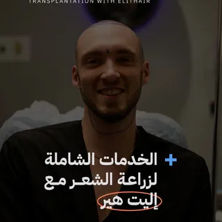 تجربة كاملة وخدمات سياحة علاجية 
لرحلة زراعة الشعر مميزة ولا تنسى 

صفر ألم 0️⃣
تقنيات تخدير Deep-Sl