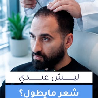 عندك شعر في الرأس مايطول؟ 

دكتور بلوي يشرحلك السبب بالتفصيل