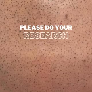 Before diving into Scalp Micropigmentation (SMP), make sure to do your homework! Choosing the right 