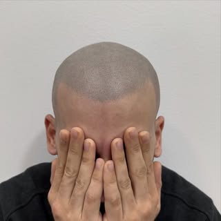 Guau! Increíble cambio 🔥👀 Quieres resultados? Quieres recuperar tu confianza? Te podemos ayudar! D