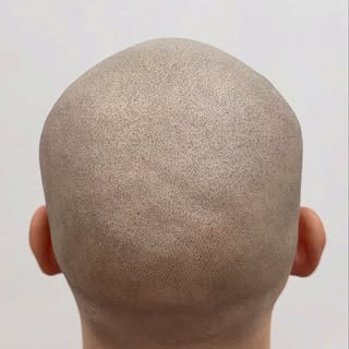 ¿Cansado de las herraduras? Tenemos la solución. ¡Se acabaron los sombreros! 🧢 ¿Te interesa el trat