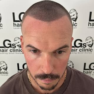 Cabello fino? No problema 🤝🏼 Añadimos más densidad a la línea frontal y a la coronilla de este cli