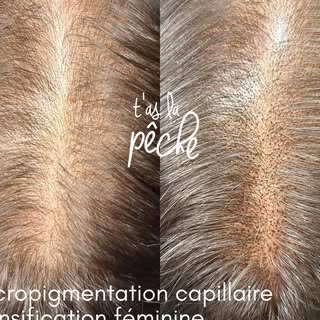 Première session de densification capillaire féminine