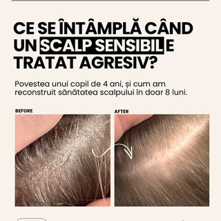 Ce faci când nimic nu pare să funcționeze? Când scalpul e tot mai sensibil, părul cade, iar tratamen