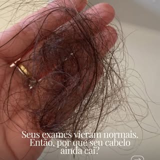 Seus exames podem estar dentro da referência… mas será que estão no nível ideal para a saúde do seu 