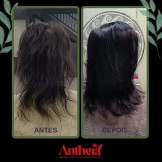 A terapia capilar é apaixonante para mim, porque quando um cliente me procura por queda capilar, afi