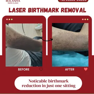 ⚠️ Kya koi aapko pigmentation ke ilaj ki 100% guarantee de raha hai?

Skin pigmentation ka treatment