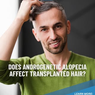 🌟Is transplanted hair resistant to androgenetic alopecia?🌟

The answer lies in one of the most imp