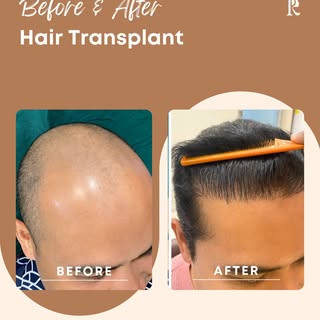 Small changes today can lead to big transformations tomorrow. ✨

This before & after showcases the p