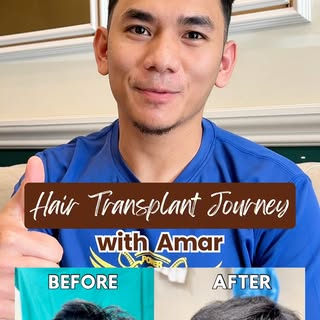 Every hair restoration journey is unique.

Hear Amar share his experience after undergoing a hair tr