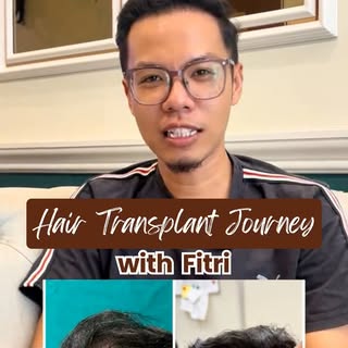 Confidence starts with taking the first step.

Watch Fitri share his hair restoration journey and ho