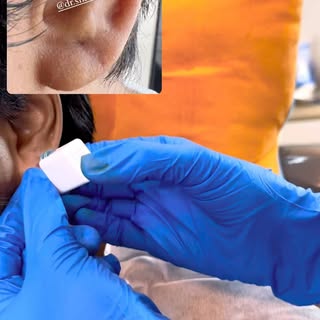 Men’s skin needs the same care as women’s @dr.shalusavla_gala 

#skincare #groomskintreatments #groo